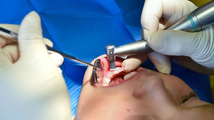 Einige Zahnarztpraxen bleiben Dienstag geschlossen